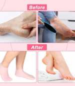 6361 SILICON GEL SOCKS FOR HEEL CRACK - Image 4
